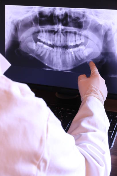 Best Emergency Treatment for Dental Infections or Abscesses in Virden, IL