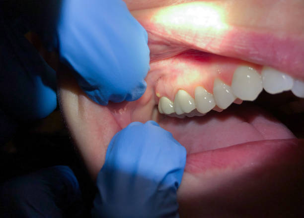 Best Weekend Emergency Dentist in Virden, IL